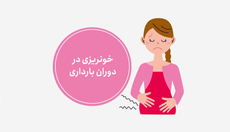 چه مقدار خونریزی در بارداری طبیعی است؟پریودی در بارداری