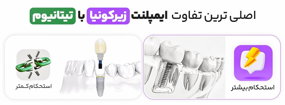 ایمپلنت زیرکونیا و تیتانیوم، محبوب&zwnj;ترین انواع هستند که باهم تفاوت&zwnj;هایی دارند.